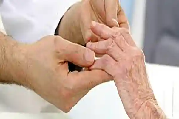 Rheumatological Disorders